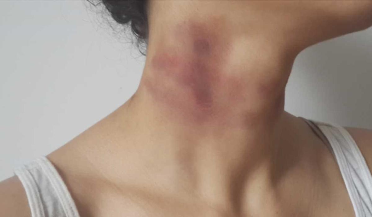 New nonfatal strangulation law by Derry domestic abuse