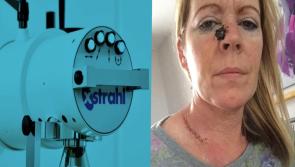 Altnagelvin skin cancer machine sitting unused for years