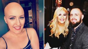 Maghera woman embracing the positives of losing her hair 