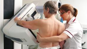 Women in Derry now able to book breast screening appointments once again