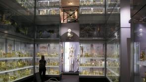 County Derry ‘giant ’ skeleton to be removed from British museum after 250 years