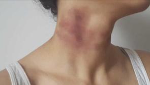 Non-fatal strangulation law comes into effect in North