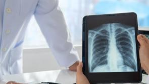 Altnagelvin radiographers to strike again in January  