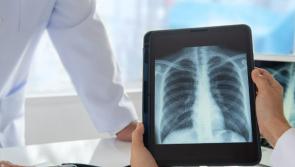 Radiographers vote to accept pay offer
