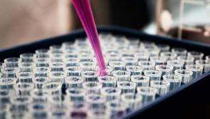 Derry researchers make 'significant breakthrough'  in early diagnosis of Chronic Kidney Disease