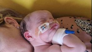 Derry baby RSV bronchiolitis warning