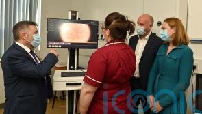 Mole-mapping service at Ulster Hospital first of its kind in Northern Ireland