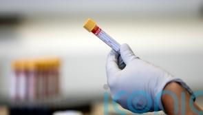 Last six months of cancer waiting times ‘worst on record’ says charity