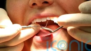 EU ban on tooth filling material will lead to ‘collapse of NHS dental services’