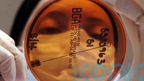 At least 37 people admitted to hospital in E. coli outbreak linked to food