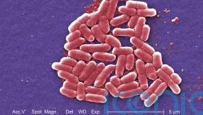 E. coli outbreak: 86 people taken to hospital but cases are slowing down