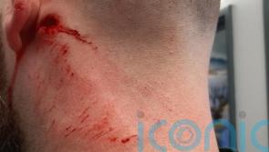 Police officer suffers head injury after masonry thrown during Belfast unrest