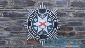 Man suffers serious facial injuries in Lisburn assault