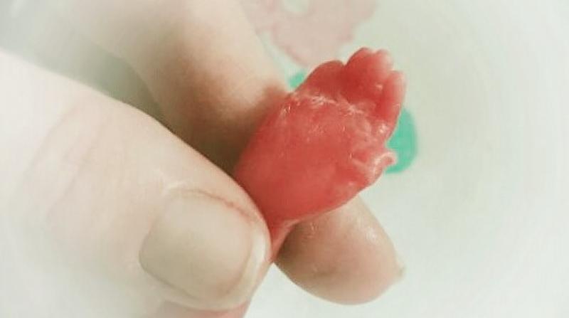 BABY LOSS AWARENESS WEEK: Silence is no remedy for grief – speak about your lost children