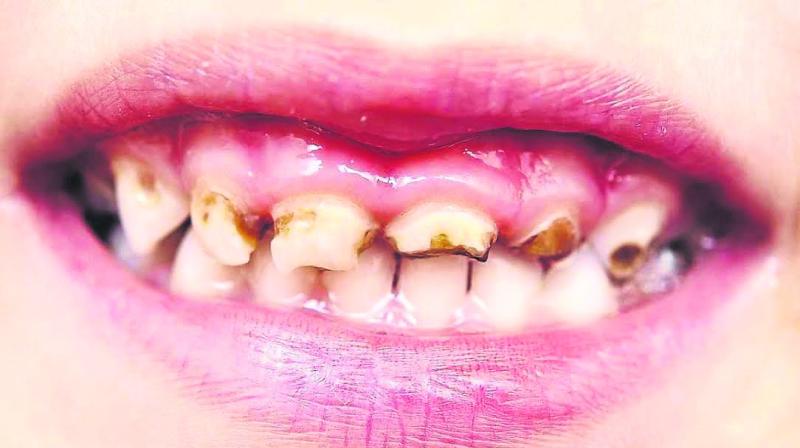 Me & You with Jennifer Griffiths: Good dental habits start young