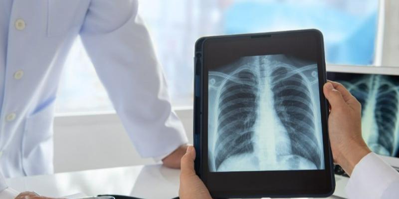 Radiographers to strike again in January  