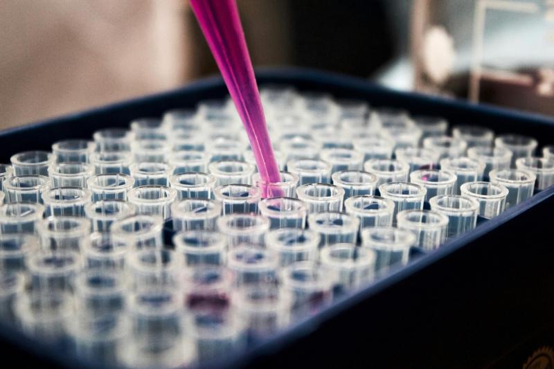 Significant breakthrough made in early diagnosis of Chronic Kidney Disease and COVID-19