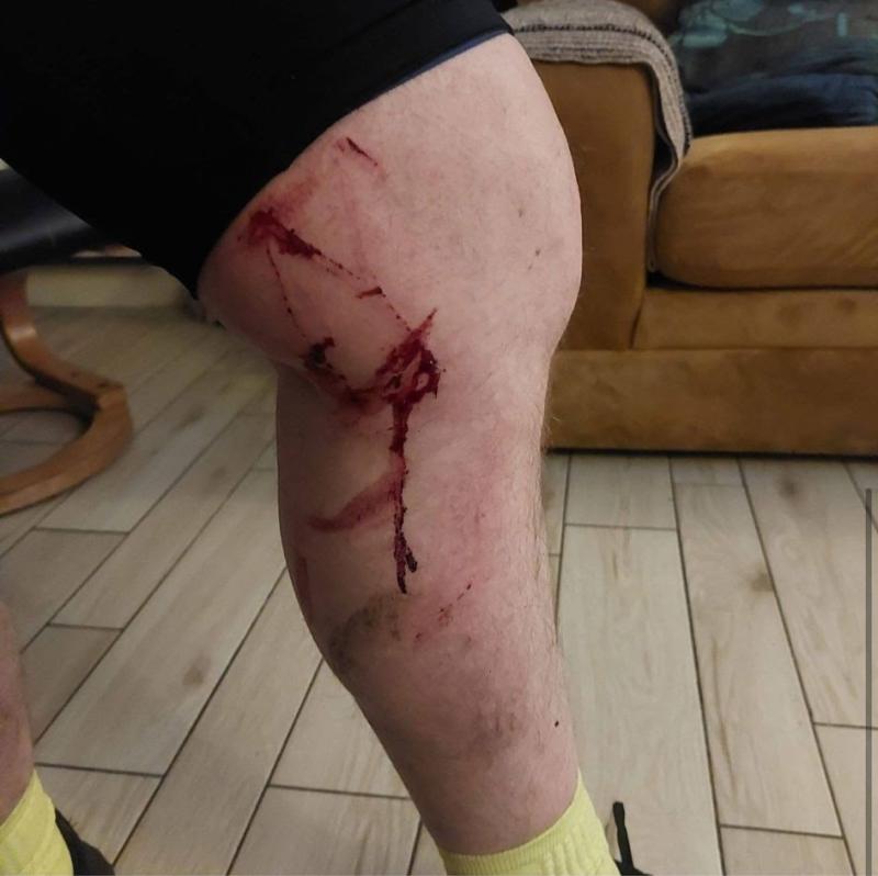 Appeal after Derry cyclist injured due to fallen trees 'Out The Line'