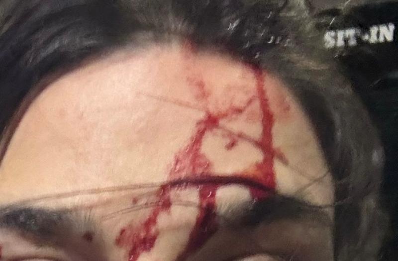 Two charged in Derry for assaulting police officers in unrelated incidents