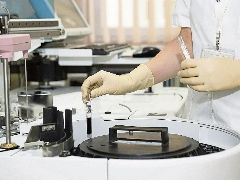 Scientists at University of Limerick prepare essential Covid-19 testing solution