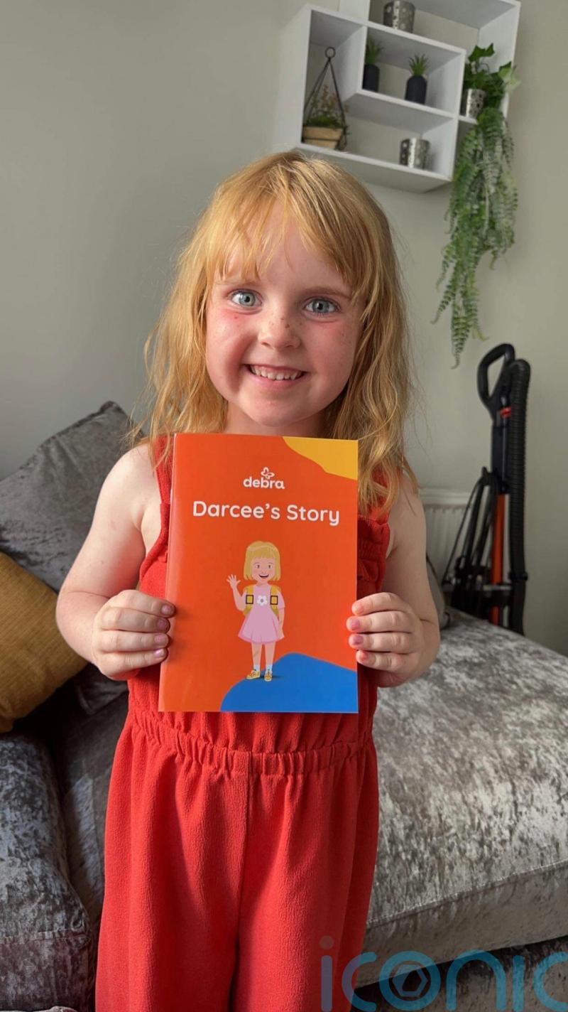 Darcee, 5, is cover star of book explaining her skin condition to classmates