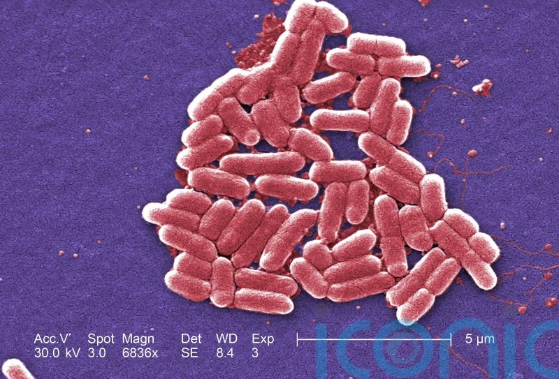 E. coli outbreak: 86 people taken to hospital but cases are slowing down