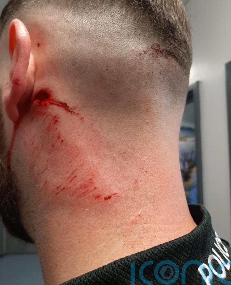 Police officer suffers head injury after masonry thrown during Belfast unrest