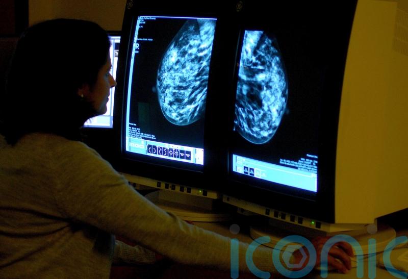 Experts warn that UK cancer care system is at ‘critical breaking point’