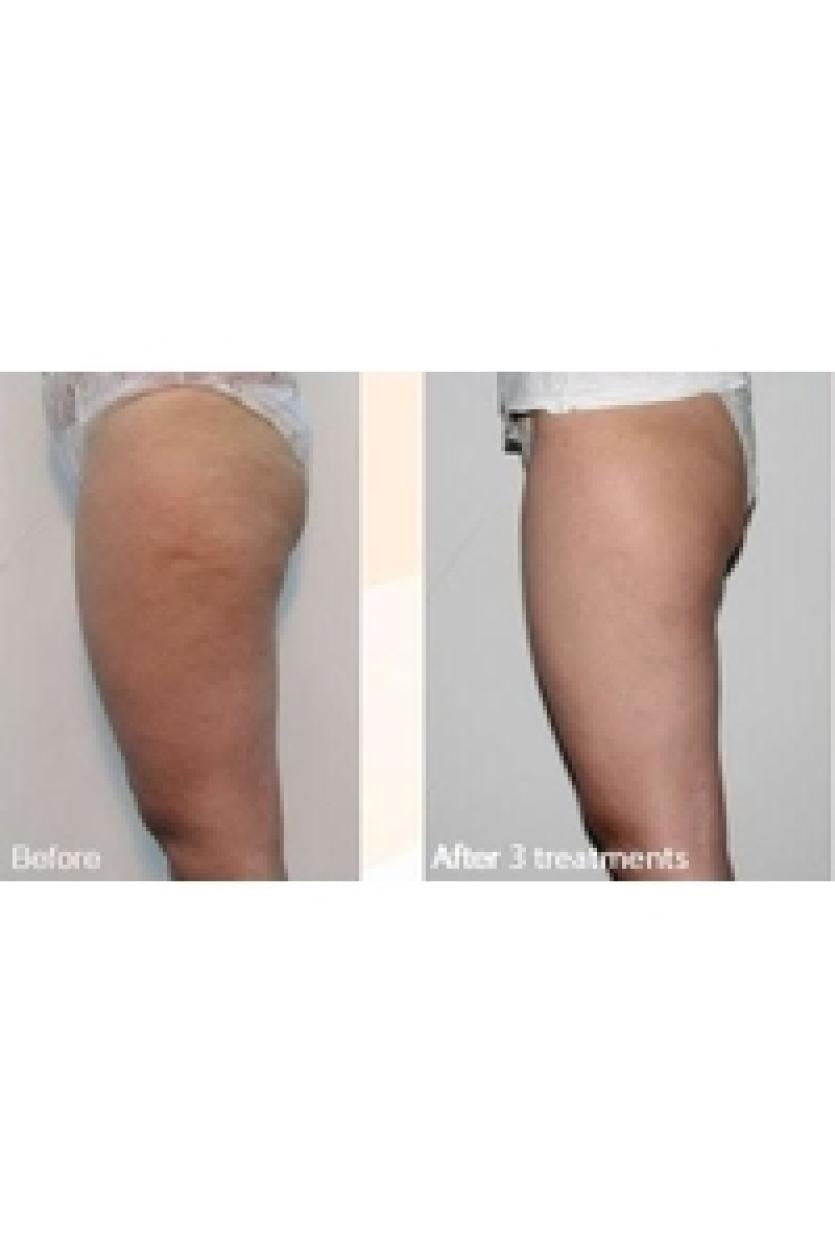 body-befor-eand-after-pic-2 resized