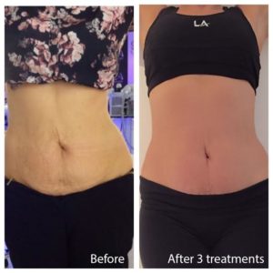 body-before-and-after-1 RESIZED