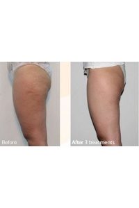 body-befor-eand-after-pic-2 resized